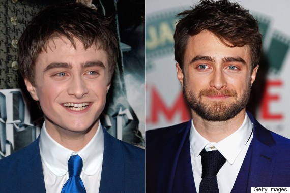 daniel radcliffe then and now