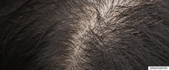 hair scalp