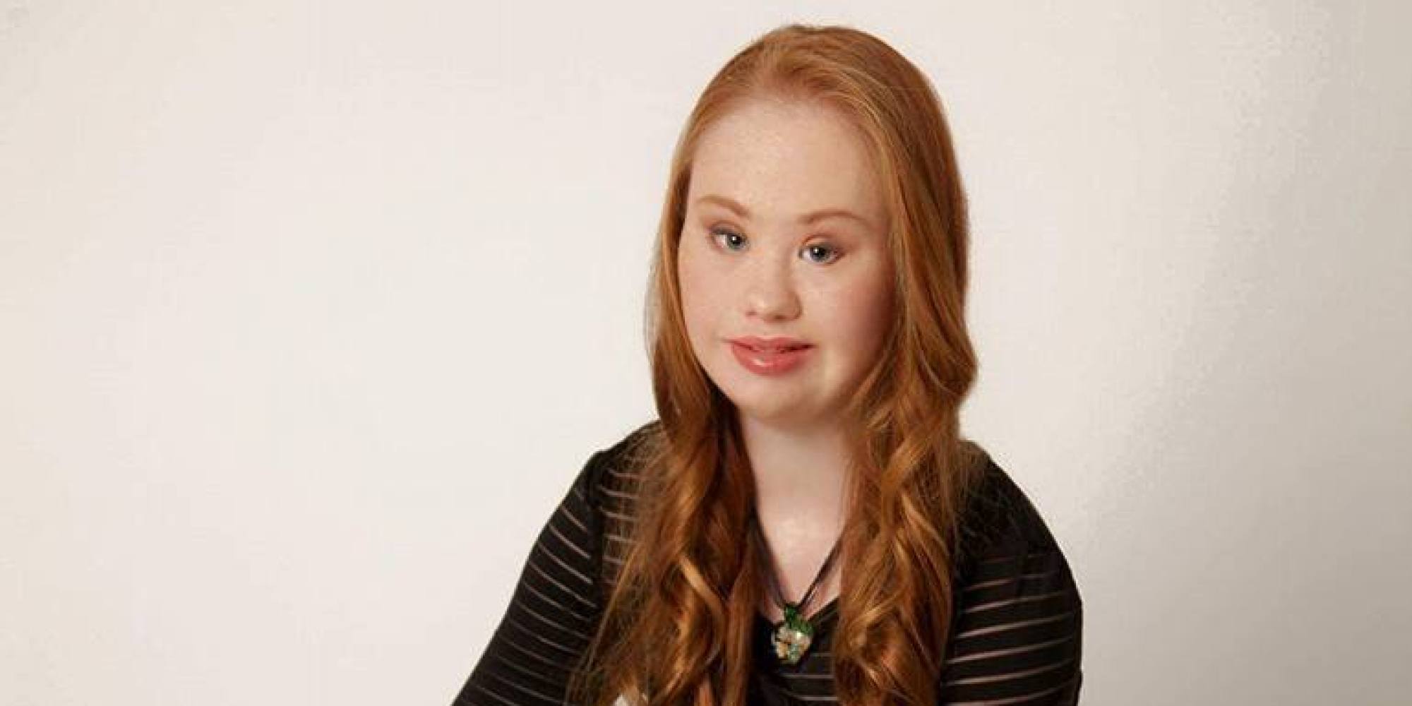 Aspiring Model With Down Syndrome Hopes To Redefine play Famous Down ...