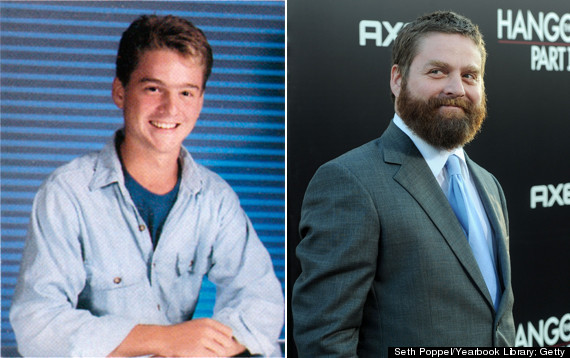 zach galifianakis high school