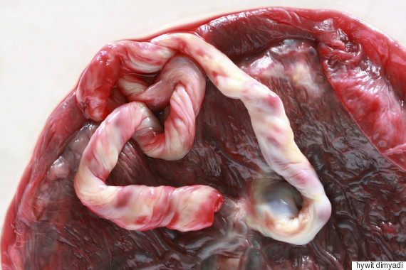 placenta