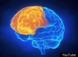 image of a human brain