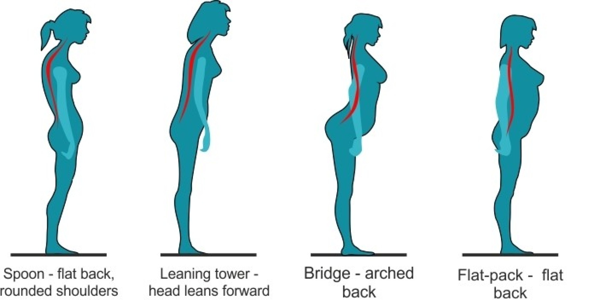 Could Poor Posture Be Causing Your Back Pain? This Graphic Reveals If ...