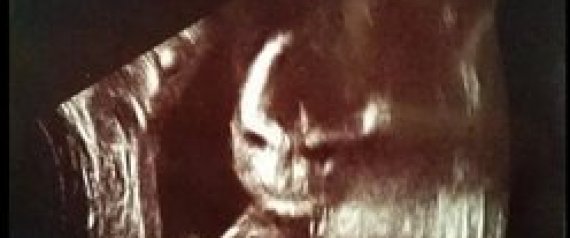 Creepy Ultrasound: 23 Images That Will Give You Nightmares