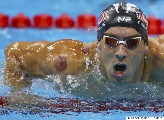 Michael Phelps' 'Cupping' Marks Are Not From Beatings