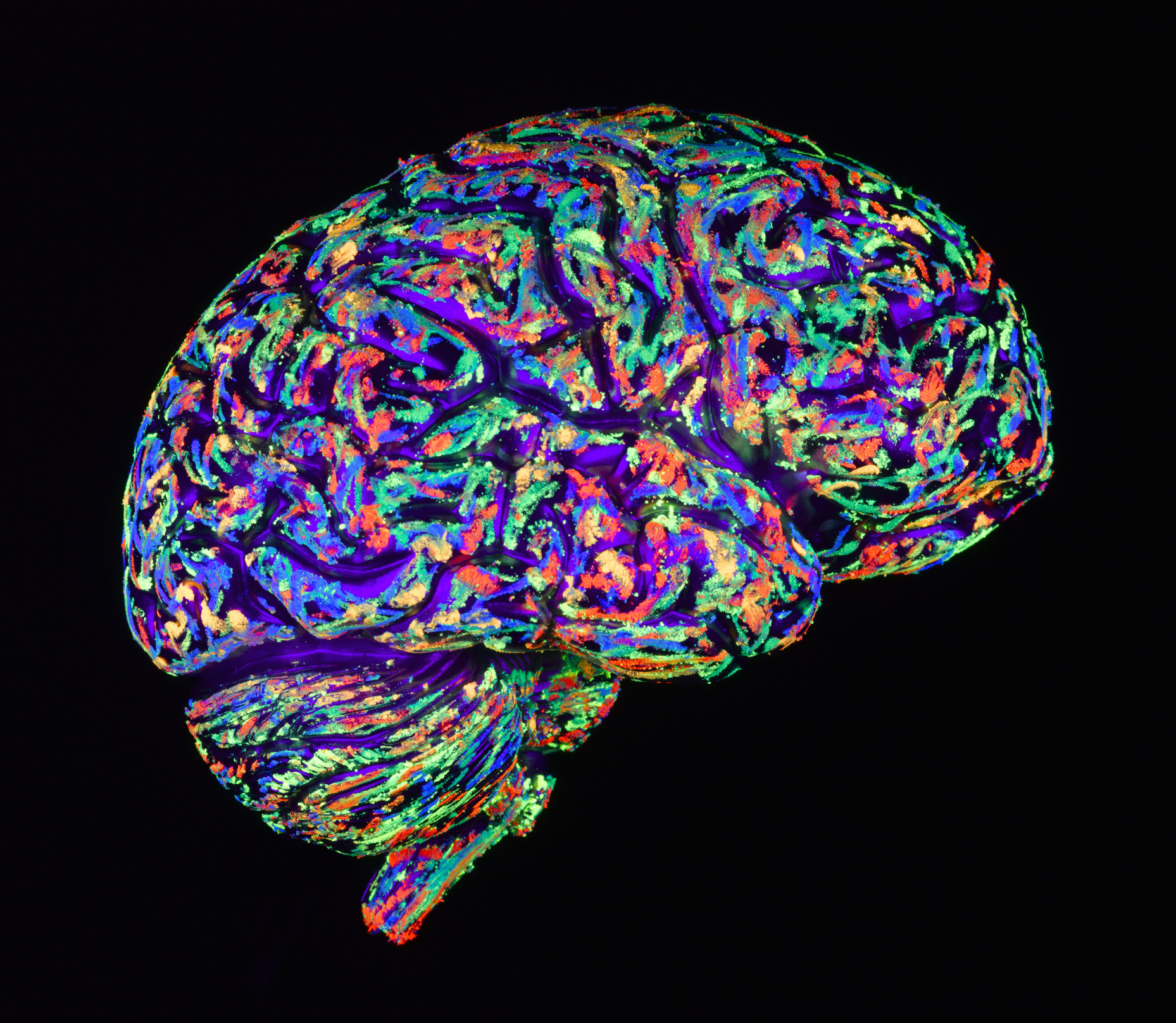 speed of neurons in the brain