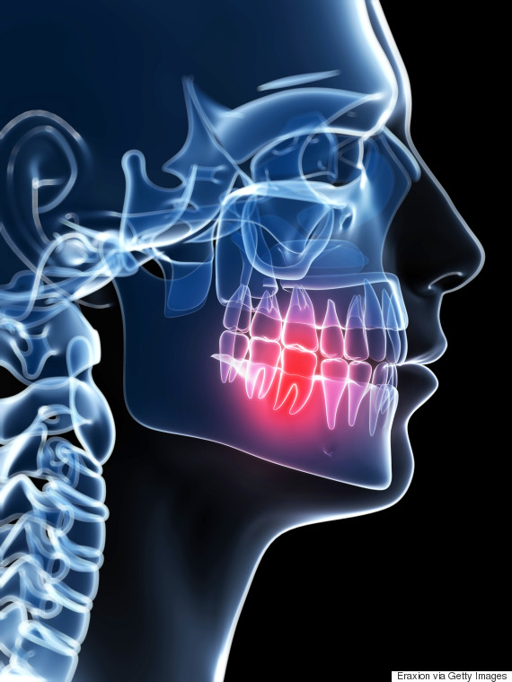 dental pain