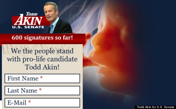 todd akin fetus