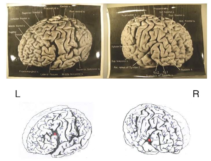 Albert Einstein s Brain May Provide Clues To His Genius Study Says 