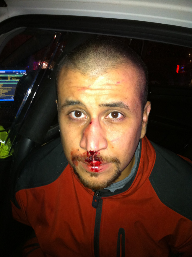 george zimmerman bloody face photo