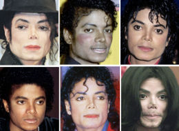 Michael Jackson's Plastic Surgeon Tells All: Restylane, Nose Jobs ...