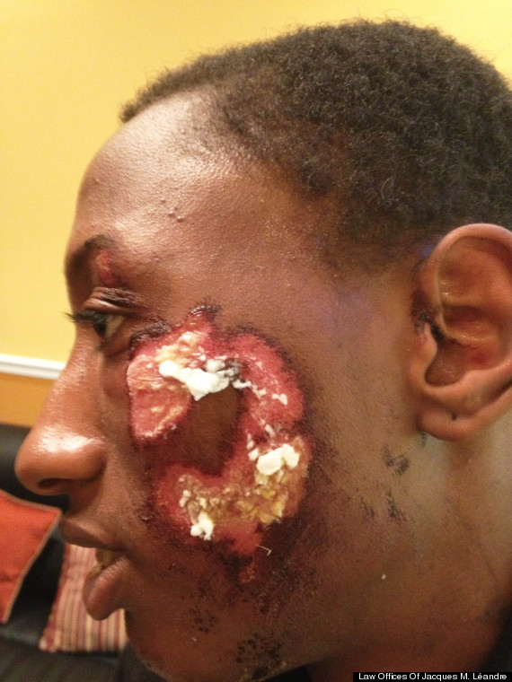 robert jackson nypd police brutality